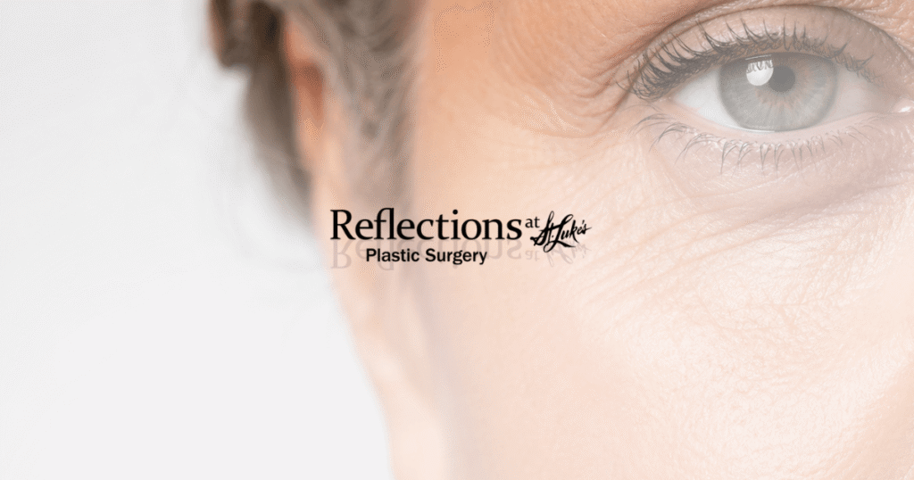 Close-up of mature woman's eye showing under-eye wrinkles and crow's feet - Decorative