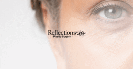 Close-up of mature woman's eye showing under-eye wrinkles and crow's feet - Decorative